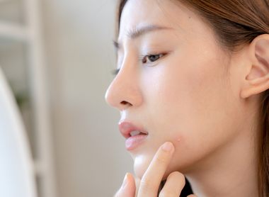 Here's The Real Deal on Sensitive Skin